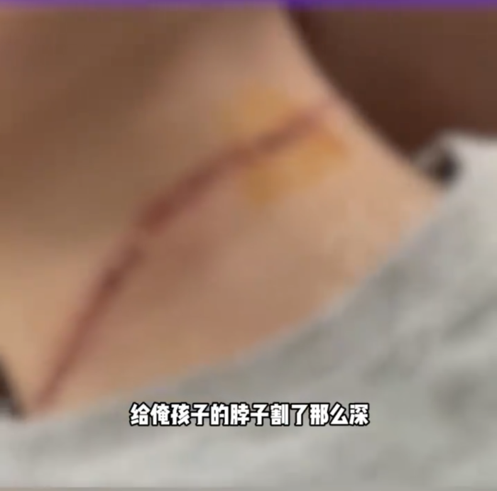 17岁男孩骑车路上遭“割喉”！2天3起，近期高发